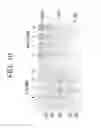 Fig. 12 - Bi-and monospecific, asymmetric antibodies and methods of generating the same