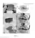 Fig. 05 - Self-healing polymers and applications thereof