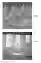Fig. 02 - Elastomeric and viscoelastic materials formed from poly(acrylic acid) gels