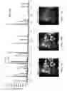 Fig. 07 - INDIVIDUALIZED CANCER THERAPY