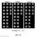 Fig. 15 - COMPOSITION FOR DIAGNOSING CANCER USING PKA ACTIVITY AND INFORMATION PROVIDING METHOD FOR DIAGNOSING METASTASIS