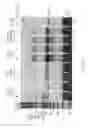 Fig. 07 - Amplification and detection of ribonucleic acids