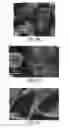Fig. 05 - Method of producing a microtube