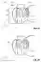 Fig. 03 - HOLE OPENER AND METHOD FOR DRILLING