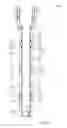 Fig. 03 - DOWNHOLE SYSTEM