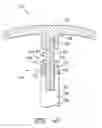 Fig. 05 - System and method for repairing dents in wind turbine tower sections and a related dent repair tool