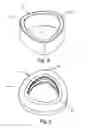 Fig. 05 - Bellows pressure relief valve