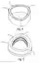Fig. 05 - Bellows anti-rotation construction