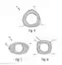 Fig. 06 - Bellows anti-rotation construction