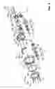 Fig. 06 - Orbital tensioner assembly