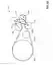 Fig. 23 - Orbital tensioner assembly