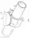 Fig. 02 - Clamp and spike for flexible conduit