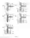 Fig. 06 - Electrophoresis device