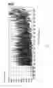 Fig. 07 - Electrophoresis device
