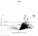 Fig. 03 - Methods and compositions for the prediction and treatment of focal segmental glomerulosclerosis