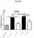 Fig. 07 - Methods and compositions for the prediction and treatment of focal segmental glomerulosclerosis