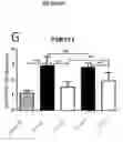 Fig. 10 - Methods and compositions for the prediction and treatment of focal segmental glomerulosclerosis