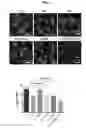 Fig. 14 - Methods and compositions for the prediction and treatment of focal segmental glomerulosclerosis