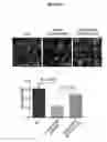 Fig. 15 - Methods and compositions for the prediction and treatment of focal segmental glomerulosclerosis