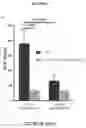 Fig. 22 - Methods and compositions for the prediction and treatment of focal segmental glomerulosclerosis