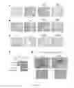 Fig. 16 - METHODS AND COMPOSITIONS FOR EVALUATING BREAST CANCER PATIENTS