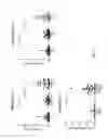 Fig. 05 - Biological marker for evaluating the IL-17 pro-inflammatory functional contribution dependent level in an individual