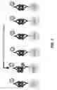 Fig. 02 - Multiplex immunoassays for hemoglobin, hemoglobin variants, and glycated forms