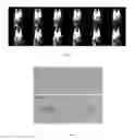Fig. 03 - Molecular Probes for Detecting Lipids