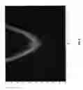 Fig. 10 - System and method for hand-held magnetic resonance imaging