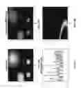 Fig. 15 - System and method for hand-held magnetic resonance imaging