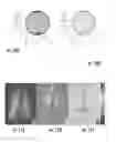 Fig. 12 - Systems and methods for assessing pulmonary gas transfer using hyperpolarized Xe MRI
