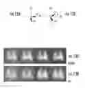 Fig. 13 - Systems and methods for assessing pulmonary gas transfer using hyperpolarized Xe MRI