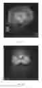 Fig. 15 - System and method for flip angle determination in magnetic resonance imaging