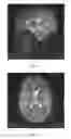 Fig. 16 - System and method for flip angle determination in magnetic resonance imaging