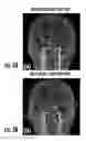 Fig. 06 - System and method for velocity selective pulses with arbitrary shape using MRI