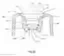 Fig. 04 - Optical lens assembly for vehicular optical imaging system
