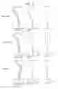 Fig. 05 - Projection zoom lens