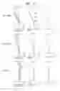 Fig. 07 - Projection zoom lens