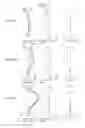 Fig. 13 - Projection zoom lens