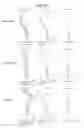Fig. 17 - Projection zoom lens