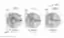 Fig. 01 - Total internal reflection aperture stop imaging