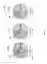 Fig. 03 - Total internal reflection aperture stop imaging