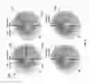 Fig. 07 - Total internal reflection aperture stop imaging