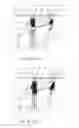 Fig. 14 - Endoscopic system