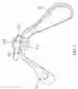 Fig. 03 - Glasses structure