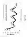 Fig. 130 - Lenses, devices, methods and systems for refractive error