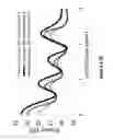 Fig. 131 - Lenses, devices, methods and systems for refractive error