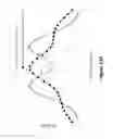 Fig. 134 - Lenses, devices, methods and systems for refractive error