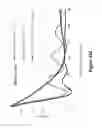 Fig. 136 - Lenses, devices, methods and systems for refractive error