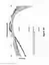 Fig. 65 - Lenses, devices, methods and systems for refractive error